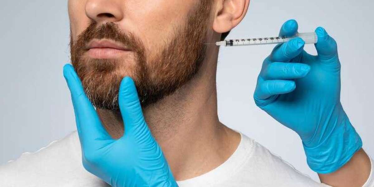 "Costo del implante de barba: soluciones asequibles"