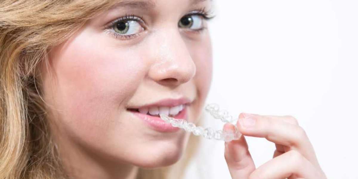 Invisalign Aligners: Comfort and Convenience in Teeth Straightening